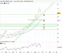 SILK ROAD MEDICAL INC. - Journalier