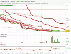 PIXIUM VISION - Wekelijks