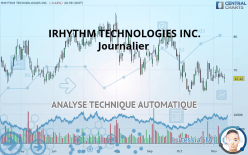 IRHYTHM TECHNOLOGIES INC. - Daily