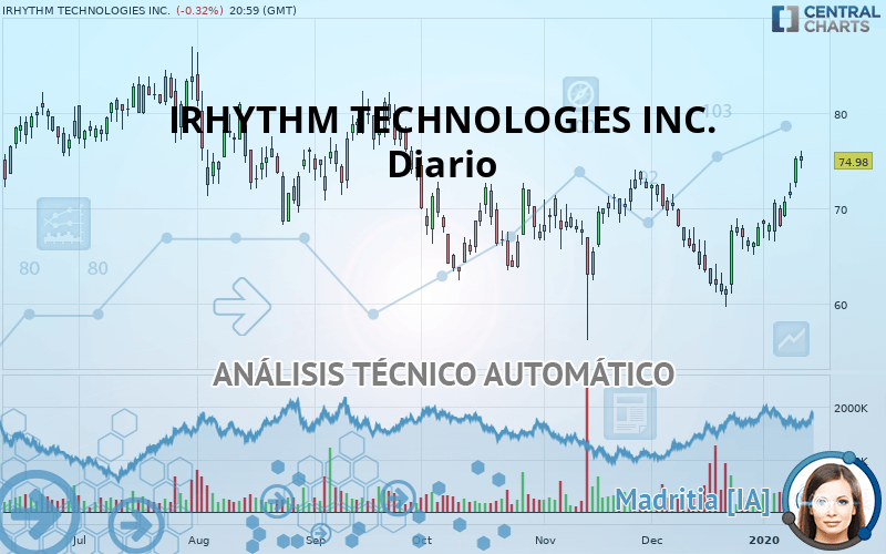 IRHYTHM TECHNOLOGIES INC. - Dagelijks